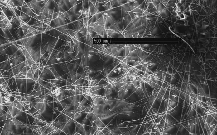 Electron microscope image of many zinc whiskers